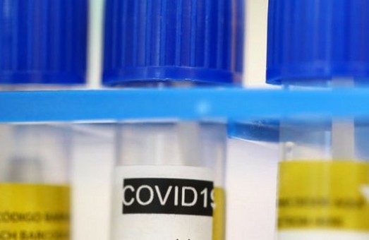 В больницах Днепропетровщины с подозрением на коронавирус находится 18 человек