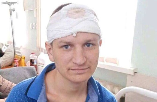 Спалился на полуниці: в криворожской больнице раненый рашист прикидывался украинцем с амнезией